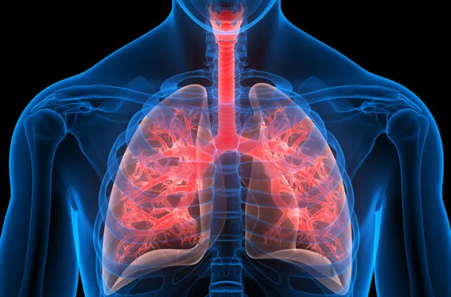 Câncer de pulmão: três medicamentos de alto custo entram para lista do SUS