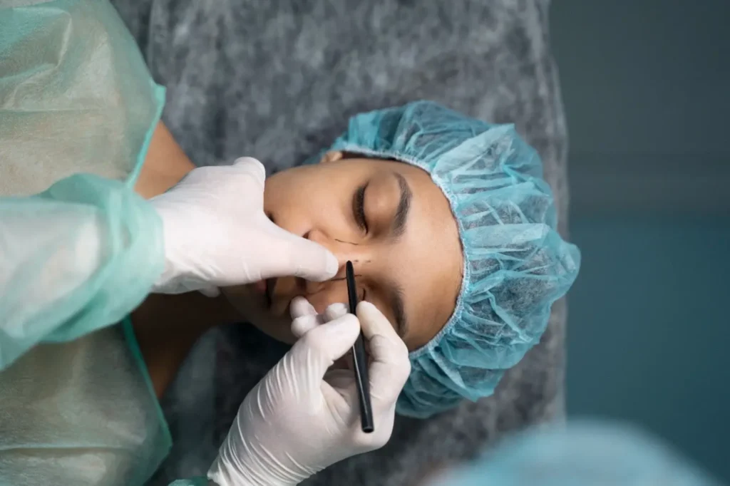 O que muitos jovens não sabem antes de fazer rinoplastia