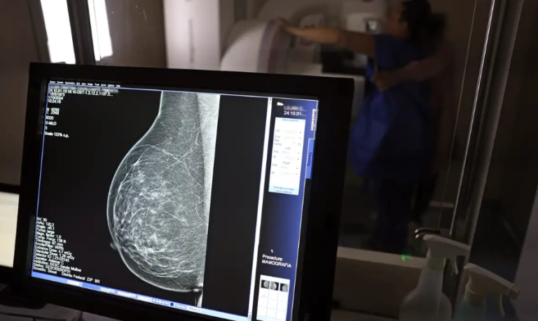 SUS amplia acesso à mamografia e ao tratamento do câncer de mama