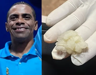 Homem morre após se engasgar com pedaço de beiju na Bahia.